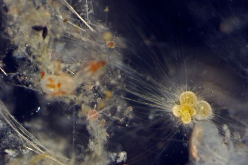 A light microscope image of a planktonic foraminifera surrounded by thin strands of its cytoplasm that extend into the surrounding environment.